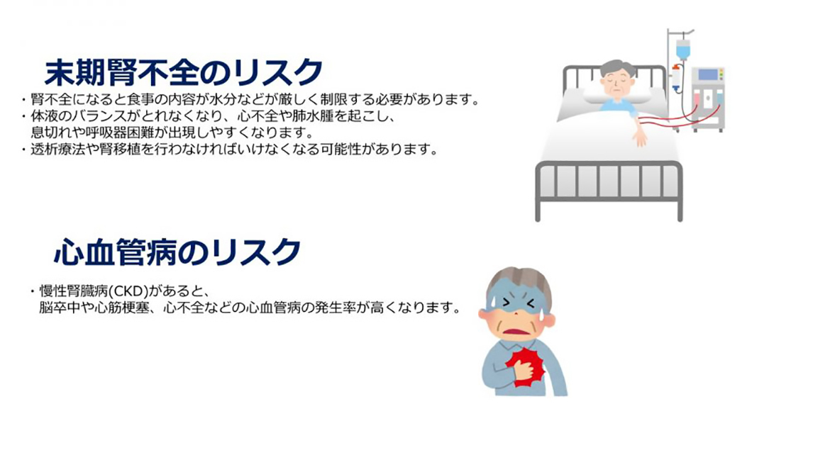 慢性腎臓病（CKD）が進行するとどうなるの